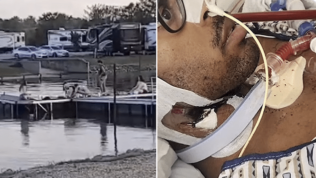 Christopher Gilbert near drowning at Louisiana lake